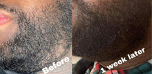 Load image into Gallery viewer, Men's Beard Growth Oil